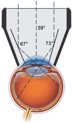 Goniolens Opticlear 4-Mirror para visualizar o ângulo da câmara anterior e a retina central e periférica