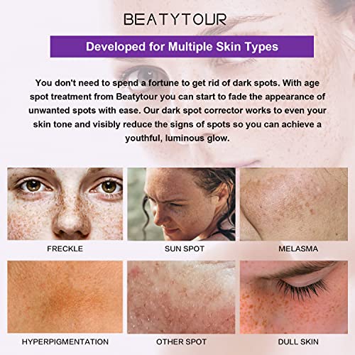 Removedor de manchas escuras de BeatyTour para tratamento de hiperpigmentação do rosto, mancha solar,