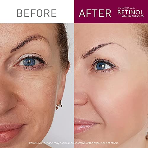 Gel de olho Retinol Vitamina A-O tratamento anti-rugas minimiza sinais de envelhecimento, inchaço e
