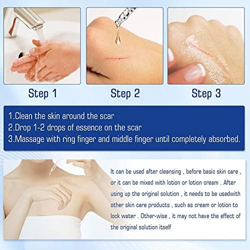 Remoção de cicatriz Soro Remova manchas de acne Tratamento estrias queimam o reparo cirúrgico