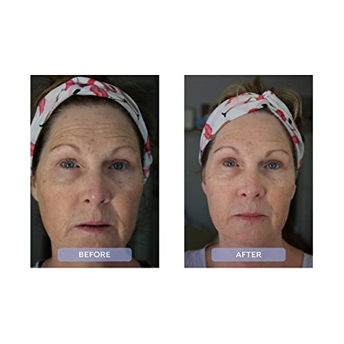 Dr. Zenovia Hormonal Dermatology Peptide + Ceramida Reparando Hidratante - Creme de rosto hidratante com
