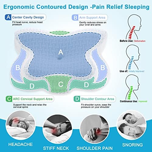 Travesseiro de espuma de memória cervical Elviros para alívio da dor, travesseiros de suporte de contorno
